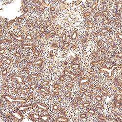 sars-cov-2 gene expression in a human fetus